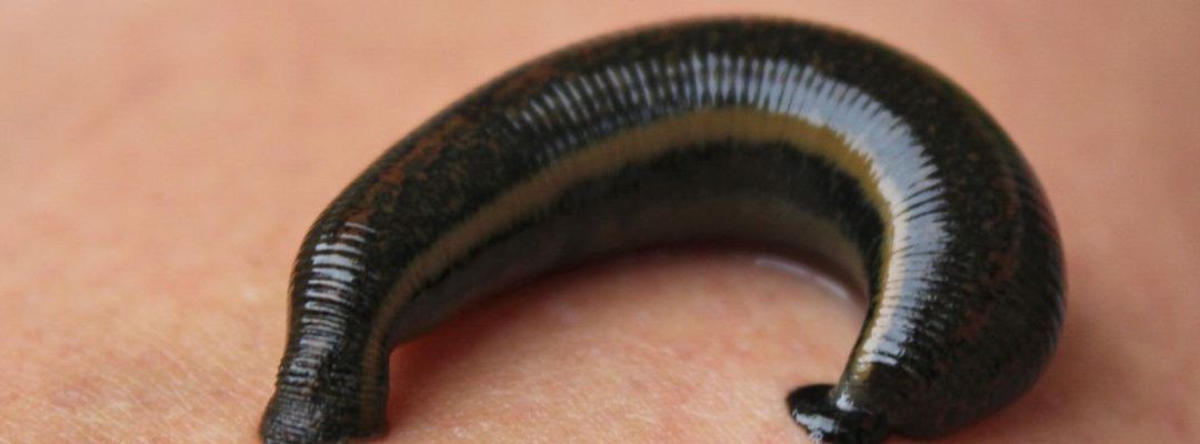 Korrekte Abrechnung einer Behandlung mit Blutegeln über das GebüH